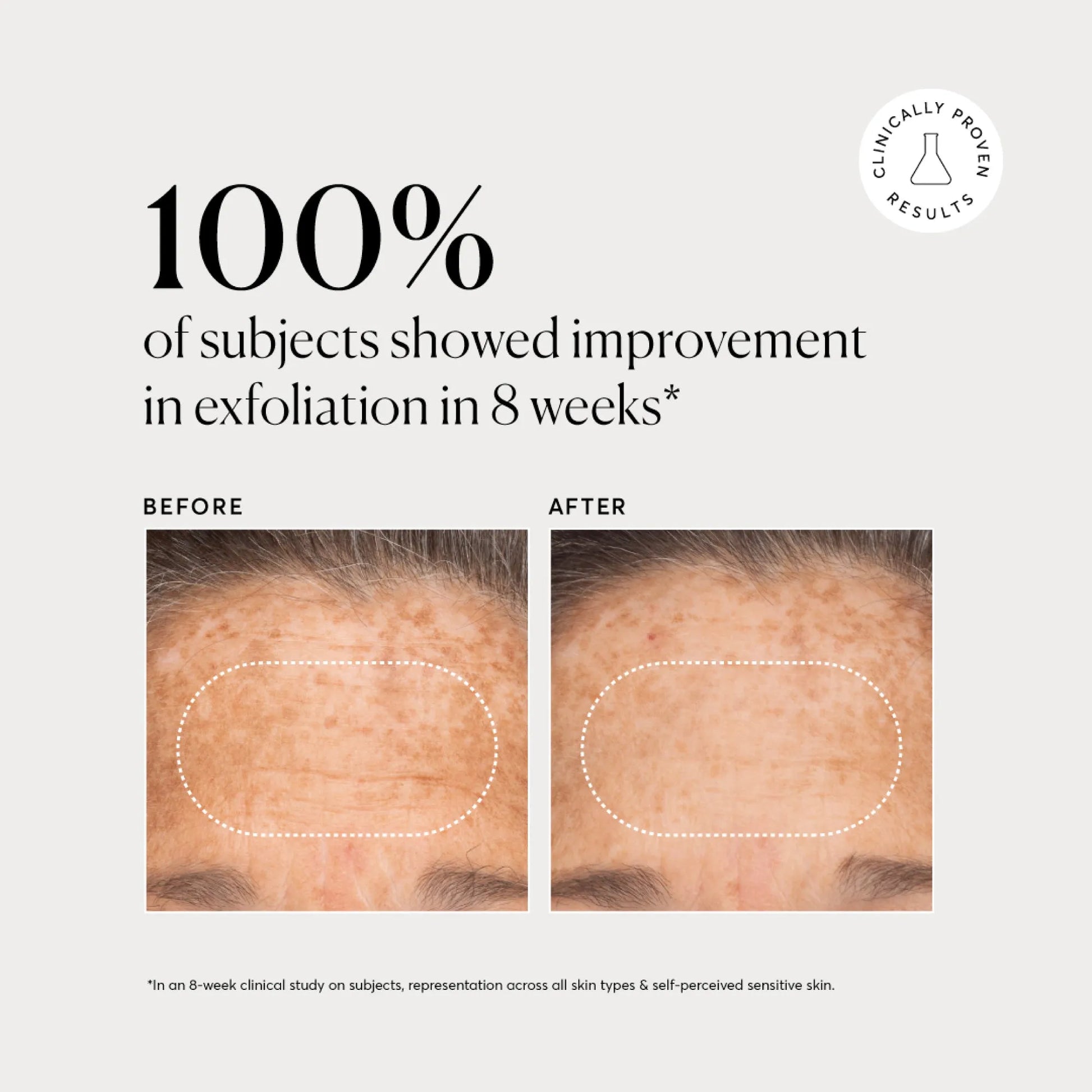 bha-liquid-exfoliant-2-u1 NATR-10027-Alt-Images-BHA-Liquid-Exfoliant-2_-03.webp