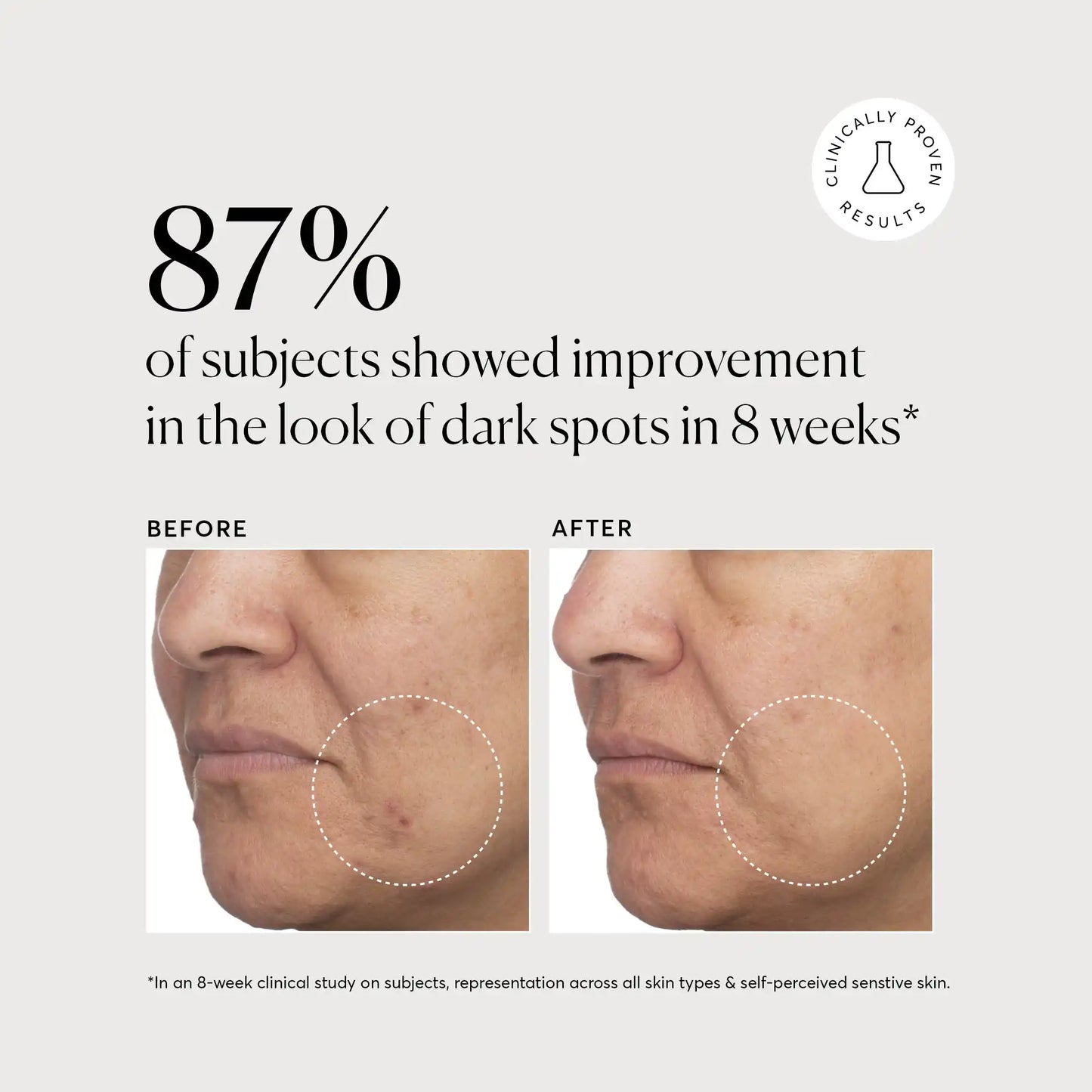 tranexamic-topical-acid-5-q3 NATR_Tranexamic_Acid_Clinical_Brighter_B_A_Bone.webp